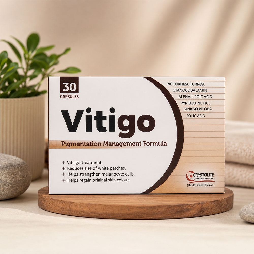 Vitigo Tablets