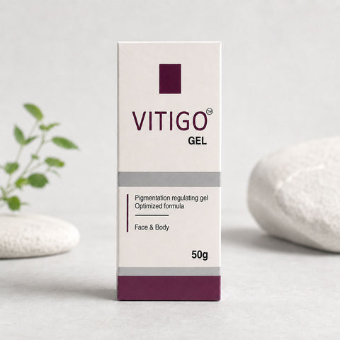 Vitigo Gel 50g