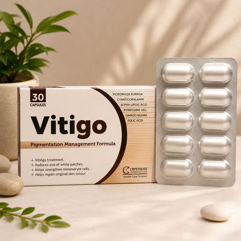 Vitigo Tablets