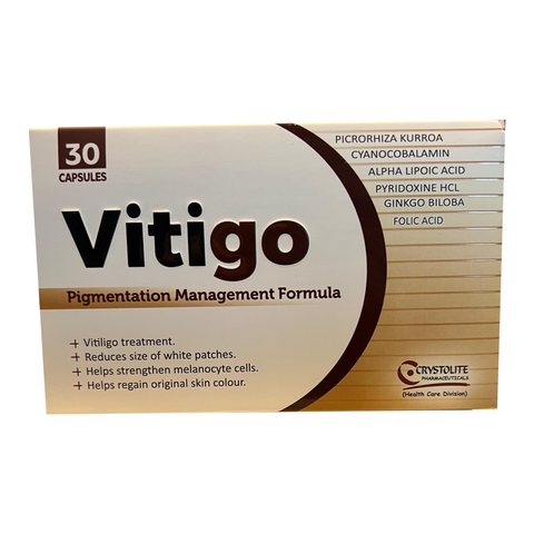 Vitigo Vitiligo Treatment